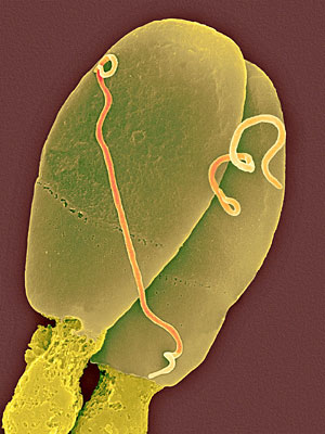 Dos espermatozoides infectados con la bacteria 'Treponema pallidum'. (Foto: Dennis Kunkel)