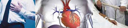 Los europeos, más propensos a padecer infartos por un rasgo genético en la sangre 